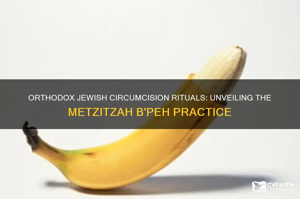 do orthodox jews suck the penis of circumcised babies