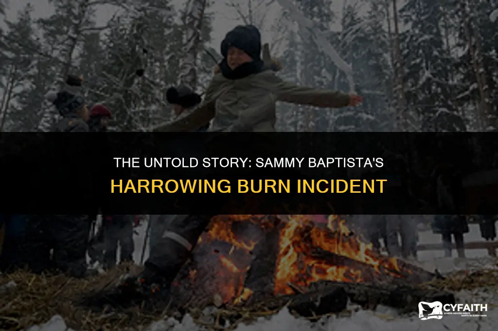 how did sammy baptista get burned