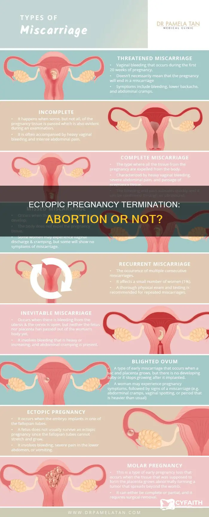 is terminating an ectopic pregnancy considered abortion catholic