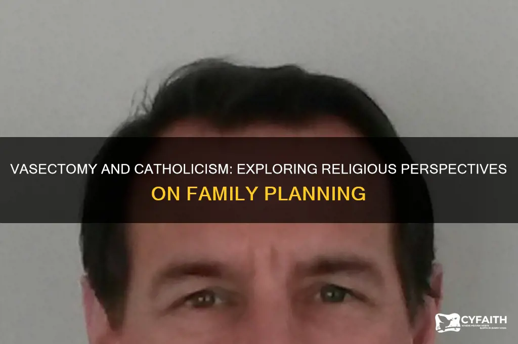 is vasectomy against catholic religion