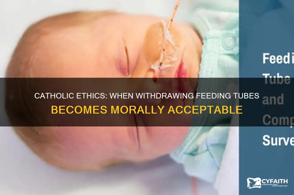 when is it permissible to withdraw feeding tube catholic