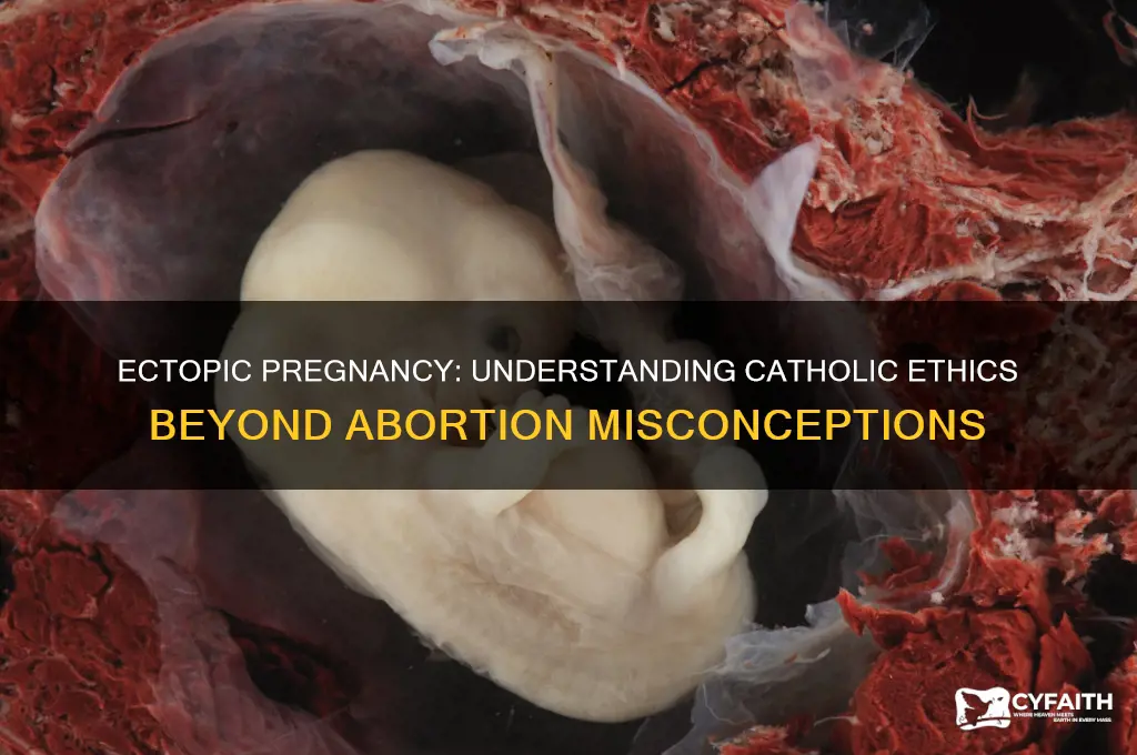 why ectopic pregnancy is not abortion catholic