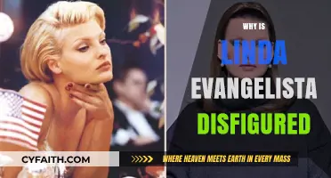 Unveiling the Truth: Linda Evangelista's Journey with Disfigurement