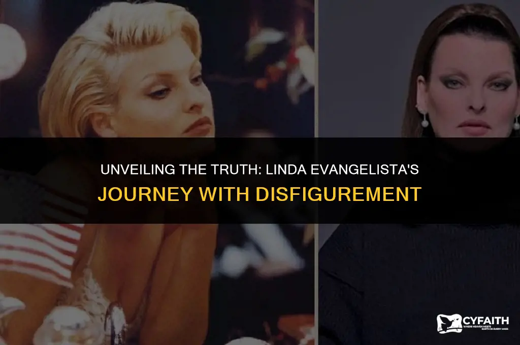 why is linda evangelista disfigured