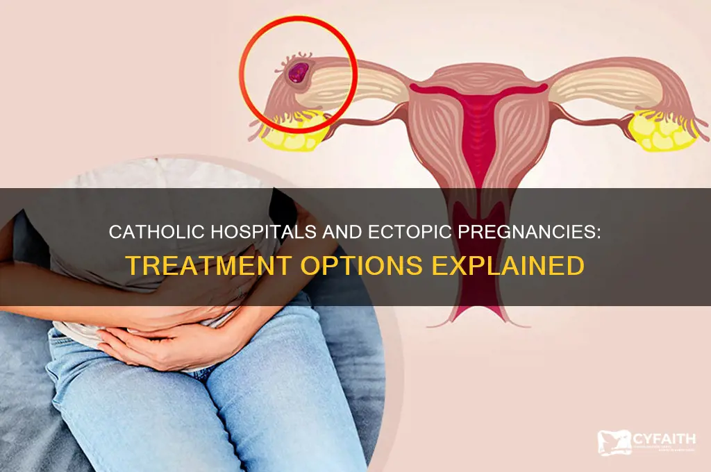 will catholic hospitals treat ectopic pregnancies
